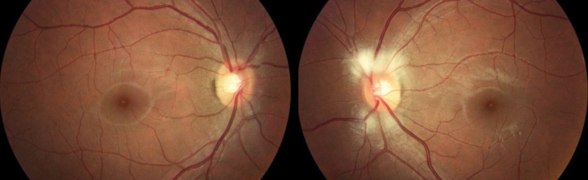 retinal imaging content